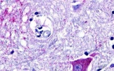 Immunohistochemistry: GPR18 Antibody [NBP3-14352]